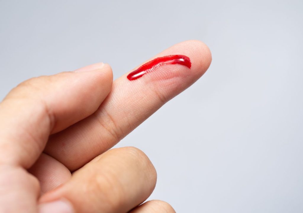 Những giấc mơ về máu có rất nhiều diễn biến khác nhau